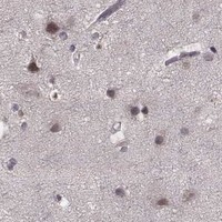 HPA IHC Cerebral cortex — ELOVL5
