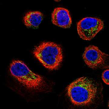 HPA017059: A-431