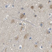 HPA IHC Cerebral cortex — SSR1