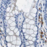 HPA IHC Colon — PRCP