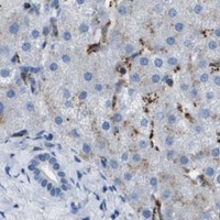 HPA IHC Liver — PRCP