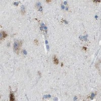 HPA IHC Cerebral cortex — PRCP