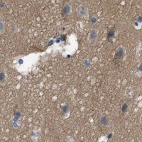HPA IHC Cerebral cortex — PTGFRN