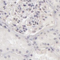 HPA IHC Kidney — ADAM10