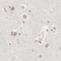 HPA IHC Cerebral cortex — ADAM10
