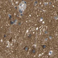 HPA IHC Cerebral cortex — CLTC