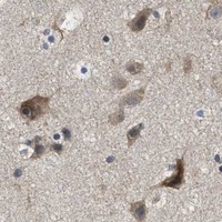 HPA IHC Cerebral cortex — DGKE