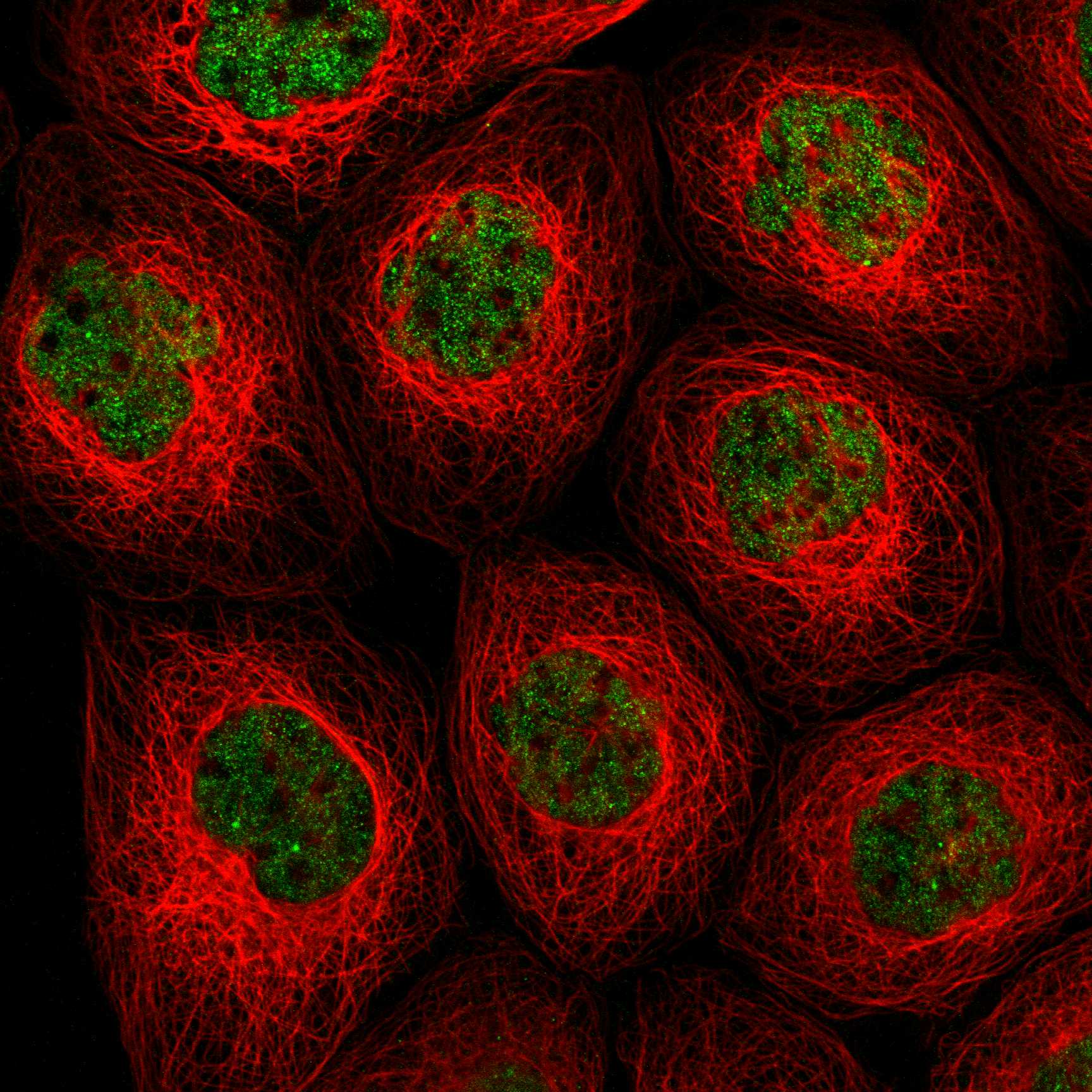 Subcellular TARDBP The Human Protein Atlas