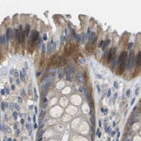 HPA IHC Colon — SCN4B