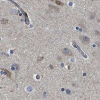 HPA IHC Cerebral cortex — SCN4B