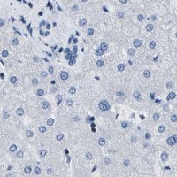 HPA IHC Liver — ADGRG6