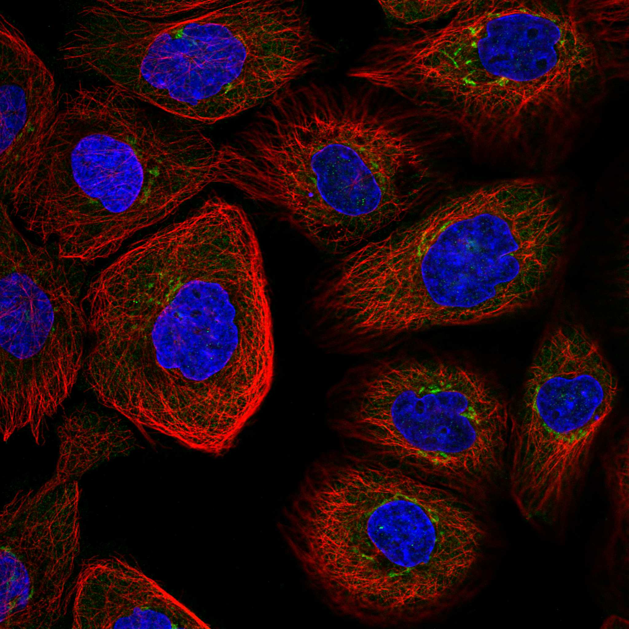 Subcellular KDELR1 The Human Protein Atlas