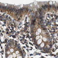 HPA IHC Colon — AP2A2