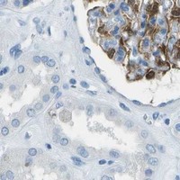 HPA IHC Kidney — FGF1