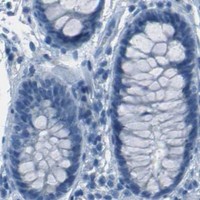 HPA IHC Colon — FGF1