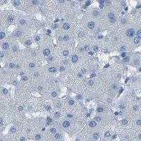 HPA IHC Liver — FGF1