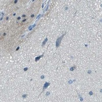 HPA IHC Cerebral cortex — FGF1
