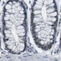 HPA IHC Colon — CBX5