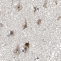 HPA IHC Cerebral cortex — CBX5