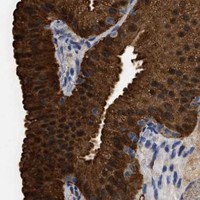 HPA IHC Gallbladder — ANXA4
