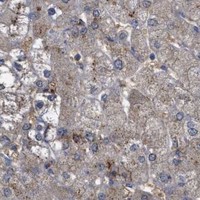 HPA IHC Liver — ANXA4