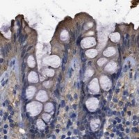 HPA IHC Colon — ANXA4