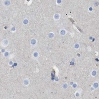 HPA IHC Cerebral cortex — ANXA4