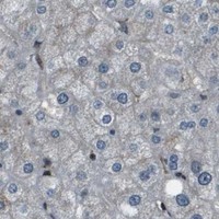 HPA IHC Liver — CXCL12