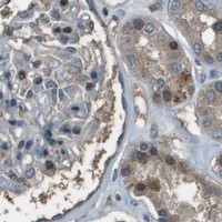 HPA IHC Kidney — CXCL12
