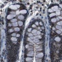 HPA IHC Colon — CXCL12