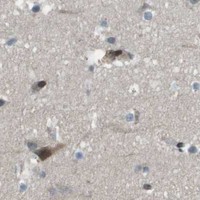 HPA IHC Cerebral cortex — CXCL12