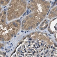 HPA IHC Kidney — DUSP6