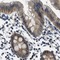 HPA IHC Colon — DUSP6