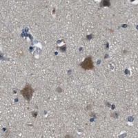HPA IHC Cerebral cortex — DUSP6