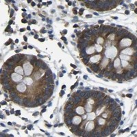 HPA IHC Colon — AIMP1