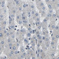 HPA IHC Liver — AIMP1