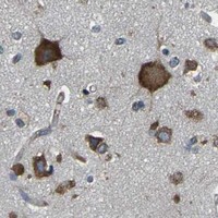 HPA IHC Cerebral cortex — AIMP1