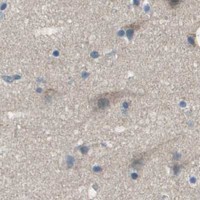 HPA IHC Cerebral cortex — PCOLCE