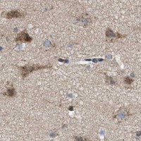 HPA IHC Cerebral cortex — PPARD