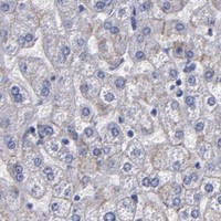 HPA IHC Liver — CDH3