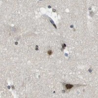 HPA IHC Cerebral cortex — IRF7