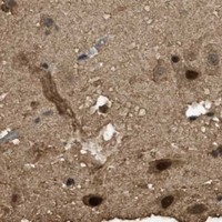 HPA IHC Cerebral cortex — MYB