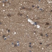 HPA IHC Cerebral cortex — THBS2