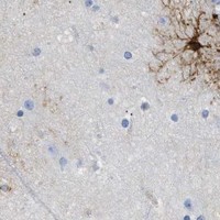 HPA IHC Cerebral cortex — DLC1