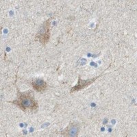 HPA IHC Cerebral cortex — CYGB