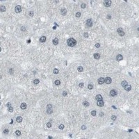 HPA IHC Liver — DEPDC1