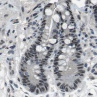 HPA IHC Colon — DEPDC1