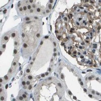 HPA IHC Kidney — DEPDC1