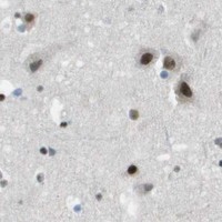 HPA IHC Cerebral cortex — DEPDC1