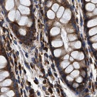 HPA IHC Colon — KTN1